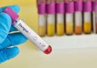 Qué es el dengue hemorrágico y cómo detectarlo