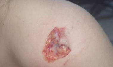 Una nena fue atacada por perros en Desiderio Tello