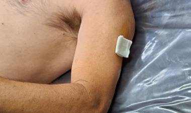 Chepes: un hombre fue herido con un arma blanca y recibió atención médica