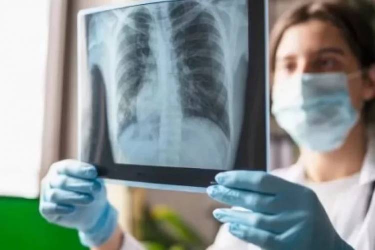 Enfermedades respiratorias: se espera el pico de casos para mitad de julio