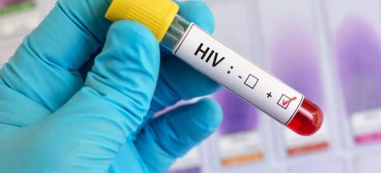 HIV: la rioja promedia unos 160 nuevos infectados por año